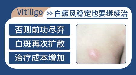 稳定期的白斑不治疗可不可以