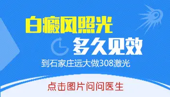 308激光治疗白癜风是剂量越大越好吗