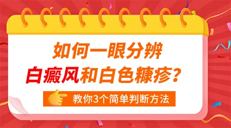 初期白癜风和白色糠疹怎么肉眼区分