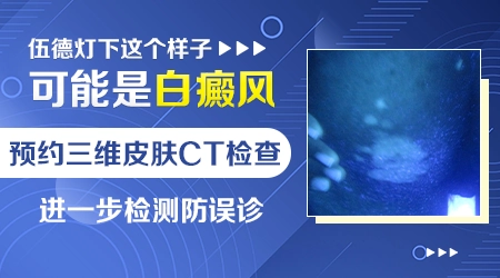 白癜风确诊需要做哪些检查