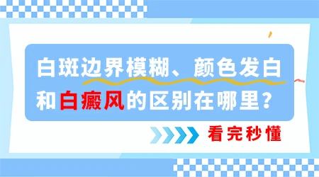 白斑边界变模糊是病情要加重扩散吗