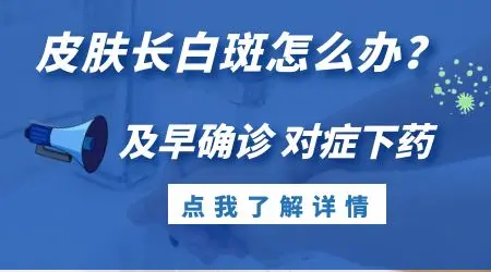 伍德灯下各种白斑会分别有什么表现