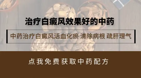 白癜风吃中药能治好吗