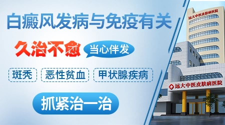 白癜风常见的病因有哪些