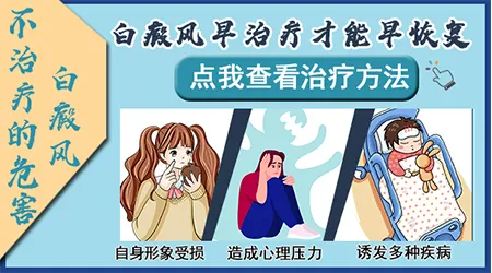 白癜风早期不治疗会怎么样