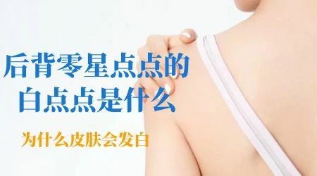 后背长白色斑块是什么情况