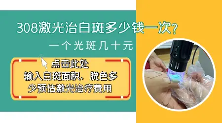 308激光照白斑价格表