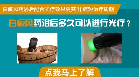 药浴治白癜风的药方