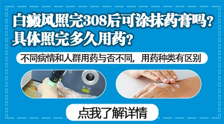 稳定期白癜风用什么药配合光疗见效快