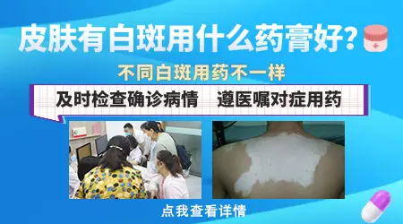怎么去治疗皮肤白斑