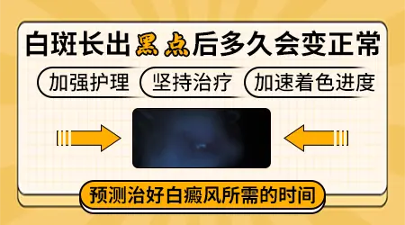 308准激光治疗白斑有效果图