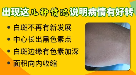 白斑恢复过程颜色变化图