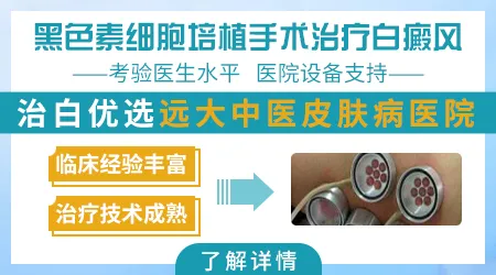 白癜风种植后白斑部位起水泡正常吗
