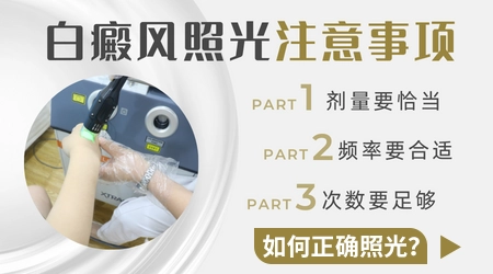 巴掌大的白癜风适合做哪种光疗