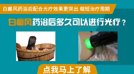 大面积白斑做全身仓光疗怎么样