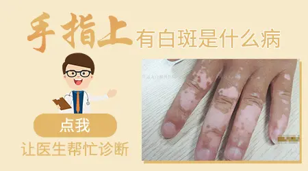 手指尖的皮肤明显发白是什么原因