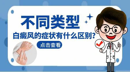 白癜风分哪几种类型 怎么区分自己的