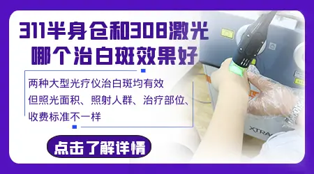 白斑照紫外线光疗仪和308激光的区别