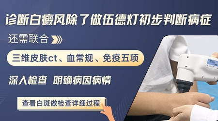 伍德灯下不同颜色的荧光分别代表什么病