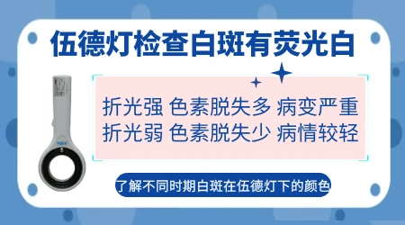 伍德灯下不同颜色的荧光分别代表什么病