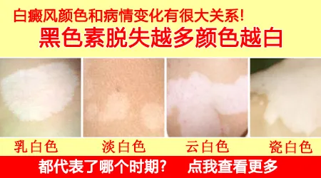 不同颜色的白斑代表什么