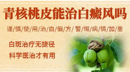 青核桃皮擦白癜风白斑的正确方法