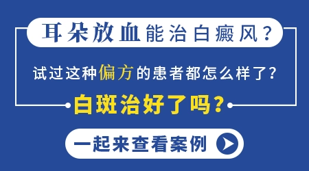 专科白癜风医院治白斑