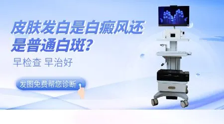 皮肤发白一定是白癜风吗?还有哪些可能