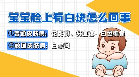 五岁宝宝脸上有白斑怎么回事