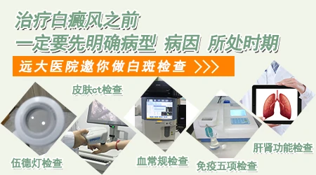 白斑检查能查出发病原因吗