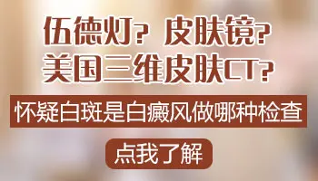 皮肤镜检测白斑会不会误诊