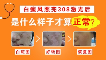 308治疗5次后不见长黑点正常吗