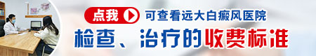 诚信医院名单：石家庄白斑医院 白斑做哪些检测