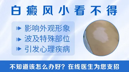 普通白斑和白癜风的白斑怎么区分
