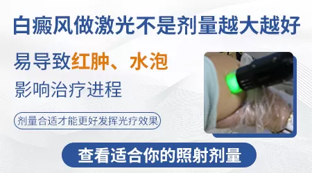 白癜风照308激光后更白了怎么回事