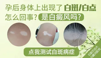 孕妇腿上有白色块块