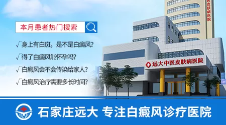 308激光治疗白癜风费用是多少