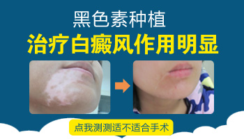 哺乳期白癜风有什么好的治疗方法