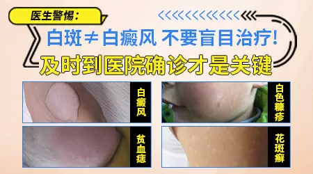 孩子脸上长小白点怎么看是什么