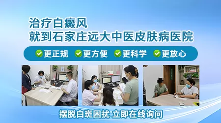 石家庄专治白癜风的医院