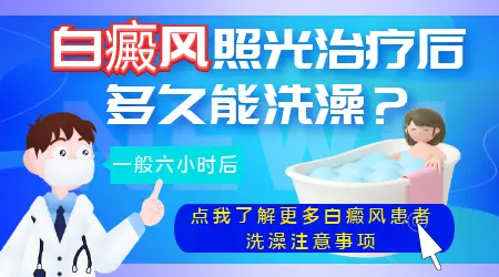308激光治疗白癜风当天可以洗澡吗