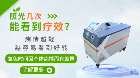 白癜风照308光几次能出黑色素