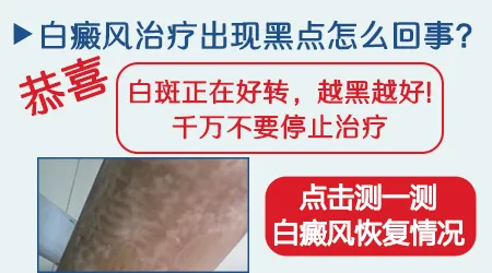白斑部位出现黑色点点是好转迹象吗