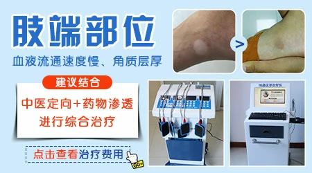 腿上中间长白点是什么原因