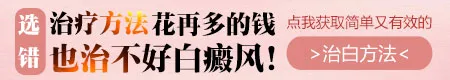 2024年治疗白癜风有什么新技术