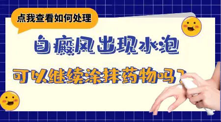 白癜风的白斑处出现水疱怎么办