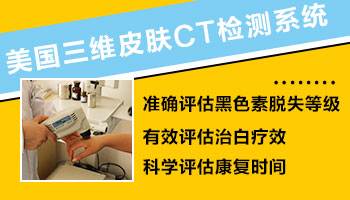 皮肤ct查白斑多少钱 石家庄哪家医院查的准