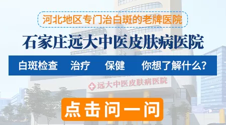所有的白癜风治好后都会复发吗