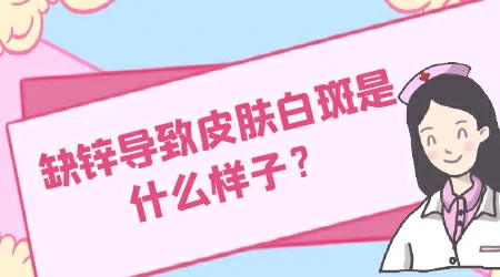 孩子脸上缺锌白斑和白癜风的区别