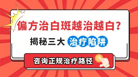 白癜风用偏方涂一涂能快速消掉吗